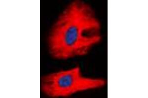 Immunofluorescent analysis of RET (pY1062) staining in K562 cells. (Ret Proto-Oncogene antibody  (C-Term, pTyr1062))