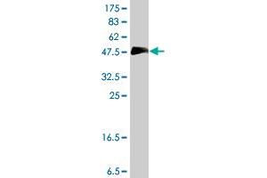 Western Blot detection against Immunogen (37 KDa) . (HOXC10 antibody  (AA 158-257))