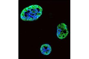 Confocal immunofluorescent analysis of HDGF Antibody (C-term) (ABIN390356 and ABIN2840767) with SK-BR-3 cell followed by Alexa Fluor 488-conjugated goat anti-rabbit lgG (green). (HDGF antibody  (C-Term))