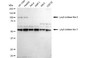 anti-Lysyl Oxidase-Like 2 (LOXL2) antibody