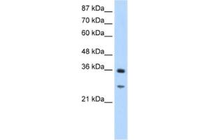 Western Blotting (WB) image for anti-GIPC PDZ Domain Containing Family, Member 2 (GIPC2) antibody (ABIN2462379) (GIPC2 antibody)