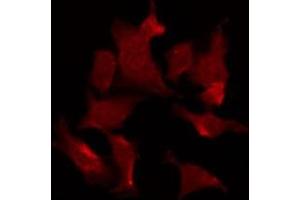 ABIN6275671 staining HT29 by IF/ICC. (Vangl1 antibody  (Internal Region))
