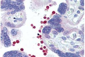 Placenta, red blood cells, Human: Formalin-Fixed, Paraffin-Embedded (FFPE) (AKT1/2 antibody)