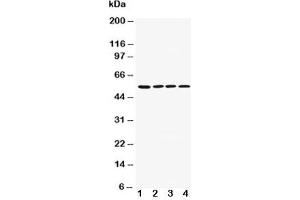 Western blot testing of AChR antibody and Lane 1:  rat brain;  2: mouse brain;  3: U87;  4: SHG-44;  5: Neuro-2a;  6: HeLa cell lysate (CHRM1 antibody  (AA 303-317))