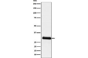 Western blot analysis of ApoD expression in Human plasma lysate.