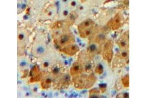 Used in DAB staining on fromalin fixed paraffin-embedded Liver tissue (CPE antibody  (AA 151-317))
