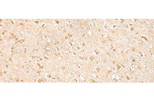 Immunohistochemistry of paraffin-embedded Human brain tissue using MED6 Polyclonal Antibody at dilution of 1:30(x200) (MED6 antibody)