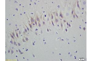 Formalin-fixed and paraffin embedded rat brain labeled with Anti-RGS5 Polyclonal Antibody, Unconjugated (ABIN680803) at 1:200 followed by conjugation to the secondary antibody and DAB staining (RGS5 antibody  (AA 81-181))