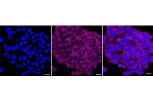 Immunocytochemical staining of HepG2 cells with Bcl10 antibody (ABIN7797717), 1:1,000). (Recombinant BCL10 antibody)