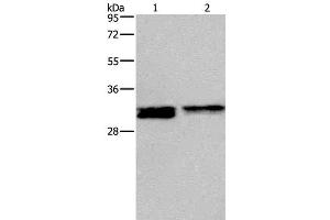 Western Blot analysis of Hela and Jurkat cell using FOSL1 Polyclonal Antibody at dilution of 1:615 (FOSL1 antibody)