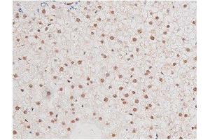 Immunohistochemistry (IHC) image for anti-Nuclear Factor-kB p65 (NFkBP65) (pSer281) antibody (ABIN6255162)