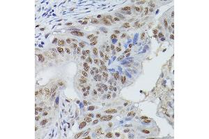 Immunohistochemistry (IHC) image for anti-MRE11 Meiotic Recombination 11 Homolog A (S. Cerevisiae) (MRE11A) (AA 1-205) antibody (ABIN3016250)