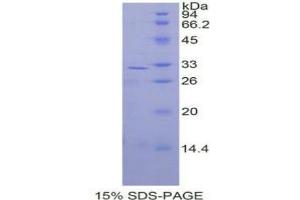 SDS-PAGE analysis of Human MAP2K3 Protein. (MAP2K3 Protein)