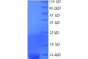 SDS-PAGE (SDS) image for Natriuretic Peptide Receptor B/guanylate Cyclase B (Atrionatriuretic Peptide Receptor B) (NPR2) (AA 22-106) protein (GST tag) (ABIN4976826)