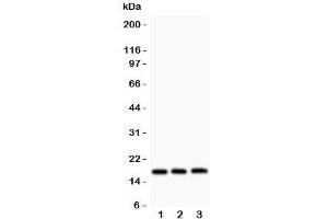 Western blot testing of FHIT antibody and Lane 1:  HT1080;  2: SW620;  3: Jurkat. (FHIT antibody  (AA 1-147))