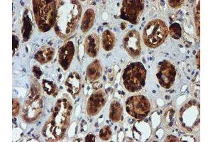 Immunohistochemical staining of paraffin-embedded Human Kidney tissue using anti-NQO2 mouse monoclonal antibody. (NQO2 antibody)
