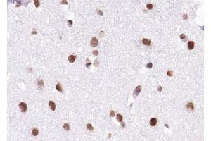 ABIN6272938 at 1/100 staining human brain tissue sections by IHC-P. (BRD7 antibody  (Internal Region))