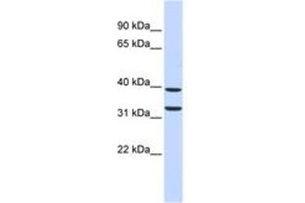 ZNF177 antibody  (C-Term)