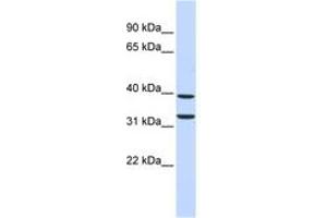 Image no. 1 for anti-Zinc Finger Protein 177 (ZNF177) (C-Term) antibody (ABIN6742763)