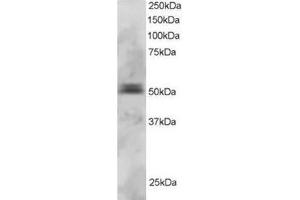 Image no. 1 for anti-Paired Box 5 (PAX5) (N-Term) antibody (ABIN374250) (PAX5 antibody  (N-Term))