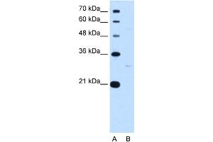 WB Suggested Anti-TEF Antibody Titration:  0. (TEF antibody  (N-Term))
