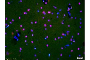 Formalin-fixed and paraffin-embedded rat brain labeled with Anti-HDAC3/HD3 Polyclonal Antibody, Unconjugated (ABIN734903) 1:200, overnight at 4 °C, The secondary antibody was Goat Anti-Rabbit IgG, Cy3 conjugated used at 1:200 dilution for 40 minutes at 37 °C and DAPI staining. (HDAC3 antibody)