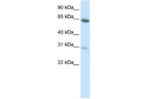 WB Suggested Anti-ZNF195 Antibody Titration:  0. (ZNF195 antibody  (N-Term))