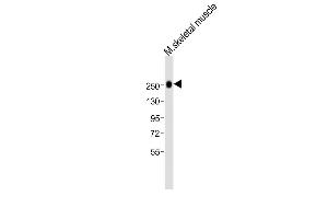 Anti-MYH1 Antibody (N-term)at 1:2000 dilution + mouse skeletal muscle lysates Lysates/proteins at 20 μg per lane. (MYH1 antibody  (N-Term))