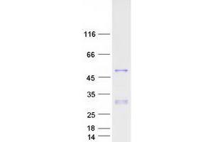 Western Blotting (WB) image for Paired Box Gene 2a (PAX2A) (Transcript Variant B) protein (Myc-DYKDDDDK Tag) (ABIN2728309)