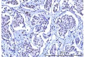 IHC analysis of RBM15B using anti-RBM15B antibody (ABIN7600219).