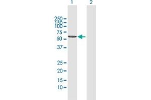 Western Blot analysis of EPHX2 expression in transfected 293T cell line by EPHX2 MaxPab polyclonal antibody. (EPHX2 antibody  (AA 1-555))