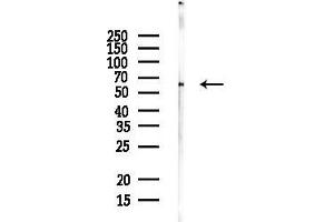 anti-Cytoplasmic Polyadenylation Element Binding Protein 1 (CPEB1) (Internal Region) antibody