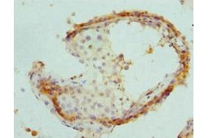 Immunohistochemistry of paraffin-embedded human testis tissue using ABIN7164913 at dilution of 1:100 (PSME1 antibody  (AA 1-249))