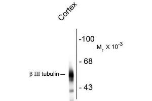 Western Blotting (WB) image for anti-Tubulin, beta 3 (TUBB3) antibody (ABIN371847) (TUBB3 antibody)