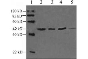 Lane 1: EasyWestern Protein Standard   Lane 2: Rabbit muscular tissue lysateLane 3: Fish tissue lysateLane 4: Hela cell lysateLane 5: Rat brain lysate Primary antibody: 1 µg/mL Rabbit Anti-alpha-Actin-1 Polyclonal Antibody (ABIN398560) The result was developed with One-Step WesternTM Complete Kit (Rabbit) (ABIN491509) (Actin antibody)