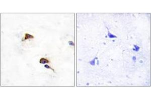 Immunohistochemistry analysis of paraffin-embedded human brain tissue, using PPIF Antibody.