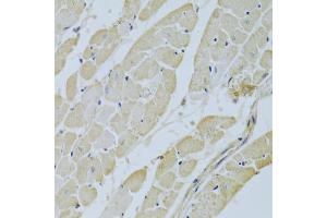 Immunohistochemistry of paraffin-embedded rat heart using C Antibody (ABIN3021738, ABIN3021739, ABIN3021740 and ABIN6215697) at dilution of 1:200 (40x lens). (CA3 antibody  (AA 1-260))