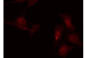 ABIN6267696 staining Hela by IF/ICC. (DARPP32 antibody  (pThr75))