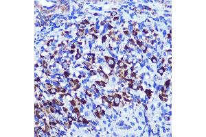 Immunohistochemistry of paraffin-embedded rat ovary using PALLD Rabbit pAb  at dilution of 1:100 (40x lens). (PALLD antibody  (AA 383-672))