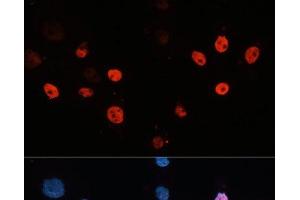 Immunofluorescence analysis of HeLa cells using HDAC3 Polyclonal Antibody at dilution of 1:100 (40x lens). (HDAC3 antibody)