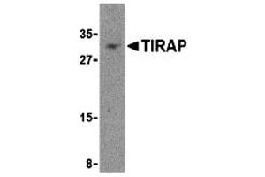 Western Blotting (WB) image for anti-Toll-Interleukin 1 Receptor (TIR) Domain Containing Adaptor Protein (TIRAP) (Middle Region) antibody (ABIN1031126) (TIRAP antibody  (Middle Region))
