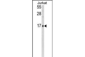 GMFG antibody  (N-Term)