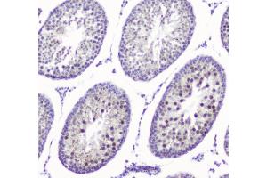 IHC analysis of SMC6L1 using anti-SMC6L1 antibody (ABIN5693133). (SMC6 antibody  (AA 205-443))