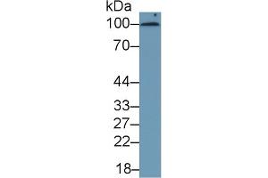 Detection of CD276 in Human Serum using Monoclonal Antibody to Cluster Of Differentiation 276 (CD276) (CD276 antibody  (AA 47-219))