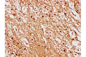 IHC image of ABIN7158375 diluted at 1:500 and staining in paraffin-embedded human brain tissue performed on a Leica BondTM system. (LIMD2 antibody  (AA 1-127))