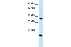 Western Blotting (WB) image for anti-Chemokine (C-C Motif) Ligand 18 (Pulmonary and Activation-Regulated) (CCL18) antibody (ABIN2463700) (CCL18 antibody)