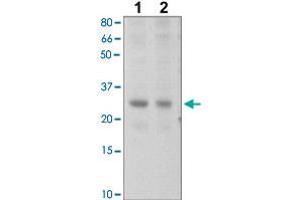 The tissue lysates derived from mouse liver (Lane 1), mouse muscle (Lane 2) were immunoprobed by SOCS2 polyclonal antibody  at 1 : 500. (SOCS2 antibody  (C-Term))