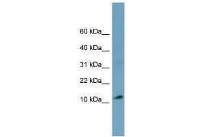 WB Suggested Anti-TRIM36 Antibody Titration:  0. (TRIM36 antibody  (Middle Region))