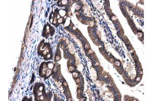 IHC-P Image GNAQ antibody detects GNAQ protein at cell membrane and cytoplasm in rat intestine by immunohistochemical analysis.