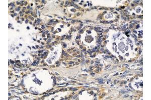 anti-Fatty Acid Hydroxylase Domain Containing 2 (FAXDC2) (C-Term) antibody